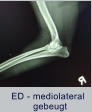 ED - mediolateral         gebeugt